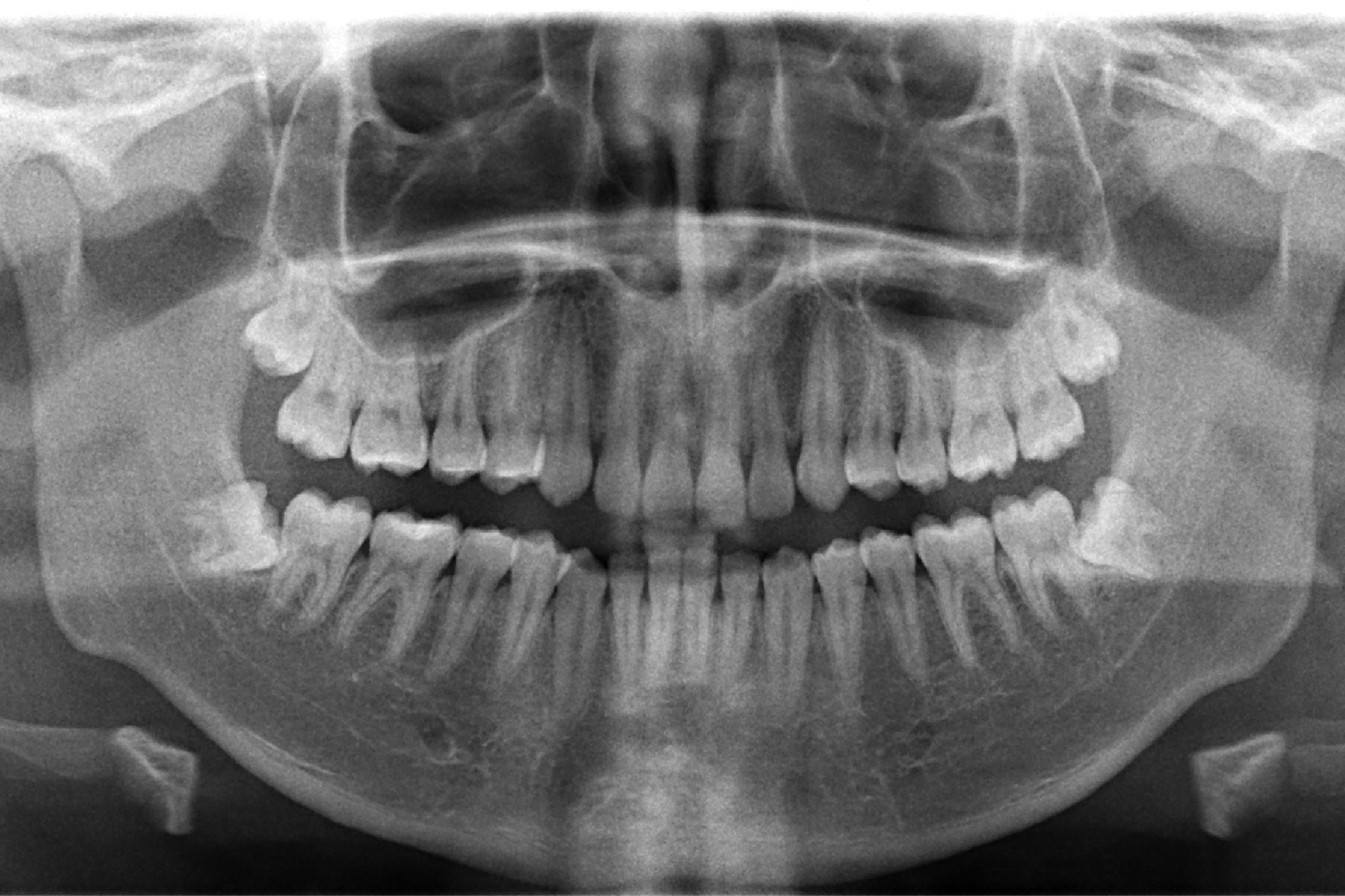 Oral Diagnosis Oral Diagnosis